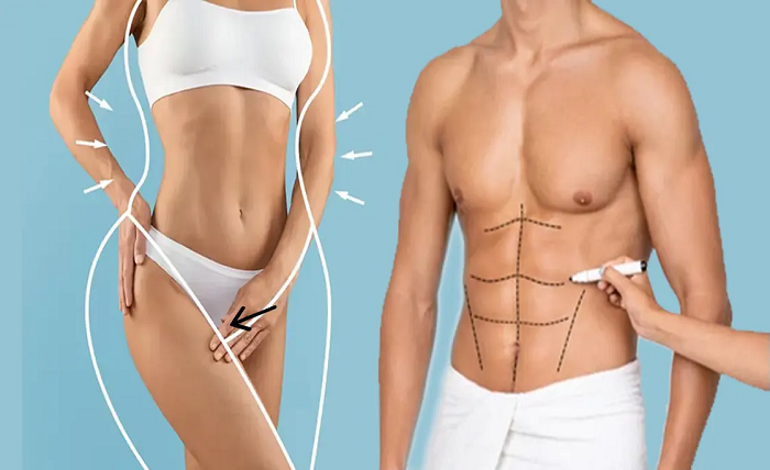 Body Contouring in Toronto to Achieve Your Ideal Physique