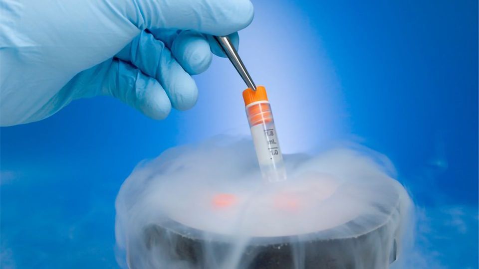 Cell Cryopreservation: A Revolutionary Technique for Long-term Storage of Cells